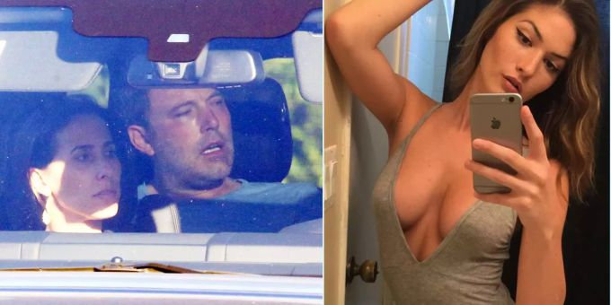 Ärzte genervt - Model bringt Ben Affleck im Entzug auf blöde Gedanken