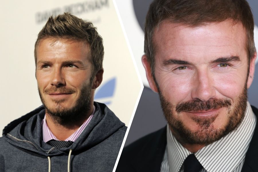 Auch bei David Beckham entstand ein «pausbackiger» Look.