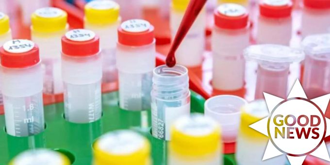 Good News - KI-Bluttest erkennt Parkinson sieben Jahre im Voraus