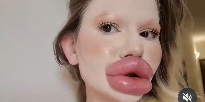 dickste Lippen der Welt