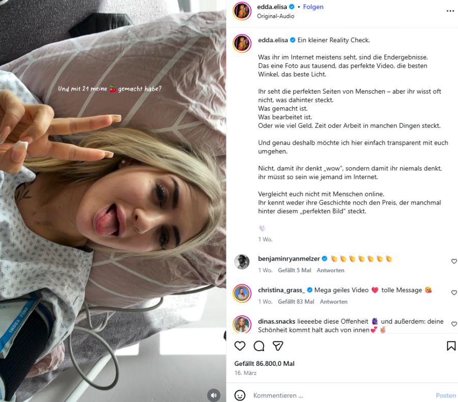 Und mit 21 liess sie sich die Brüste machen.