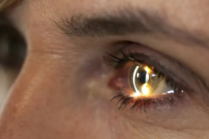 Auge