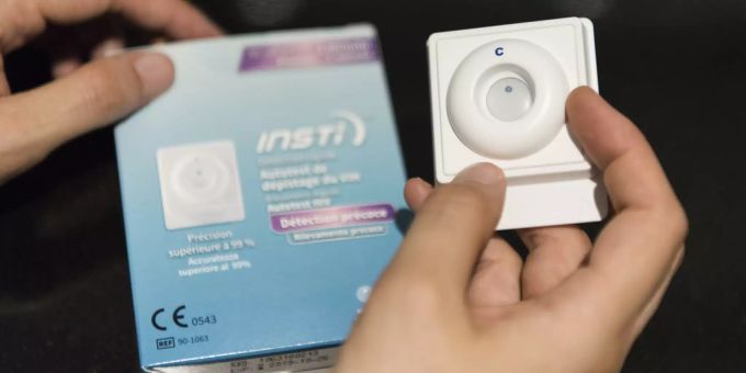 Weniger HIV-Diagnosen - 425 neu gemeldete Fälle im Jahr 2018