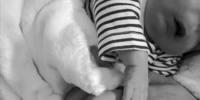 Baby In Portugal Wurde Ohne Gesicht Geboren