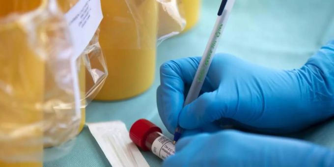 Mittlerweile sind in Deutschland mehr als 7400 mit dem Erreger Sars-CoV-2 Infizierte gestorben. Foto: Manu Fernandez/AP/dpa Mittlerweile sind in Deutschland mehr als 7400 mit dem Erreger Sars-CoV-2 Infizierte gestorben. Foto: Manu Fernandez/AP/dpa