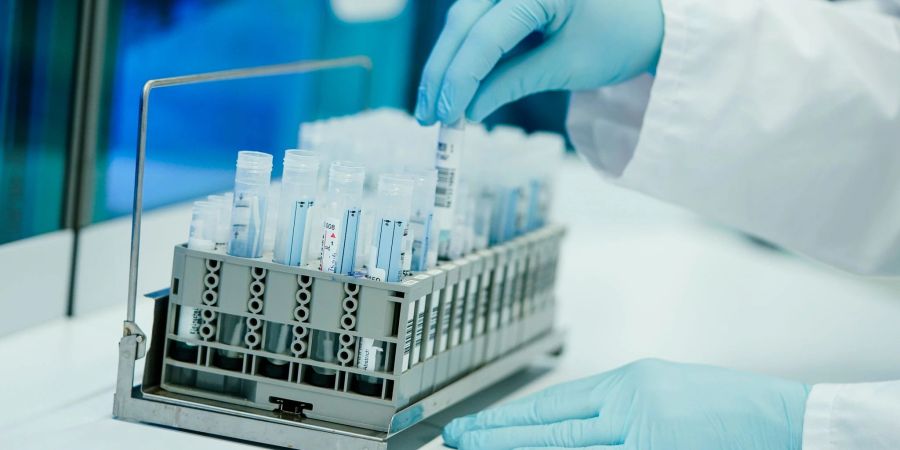 Ein Mitarbeiter hält in einem Coronatest-Labor PCR-Teströhrchen in den Händen.