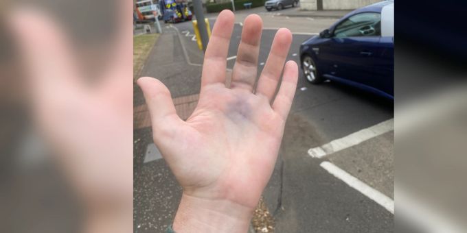 Abschlag auf Tribüne - Golfstar McIlroy bricht Fan die Hand