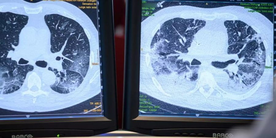 Zu welchem Zeitpunkt sollten Ärzte bei Covid-19-Patienten mit der künstlichen Beatmung beginnen? Noch ist dafür keine Standardvorgehensweise festgelegt. Foto: Sebastian Gollnow/dpa