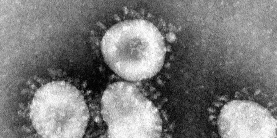 Ein Coronavirus unter dem Mikroskop. Das Malaria-Medikament Hydroxychloroquin zeigt einige positive Effekte gegen das Virus. Foto: Center for Disease Control/epa/dpa/Archivbild