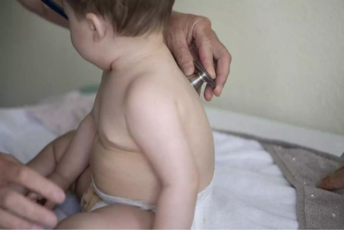 Ein Kinderarzt horcht mit einem Stethoskop. Coronavirus Kinder