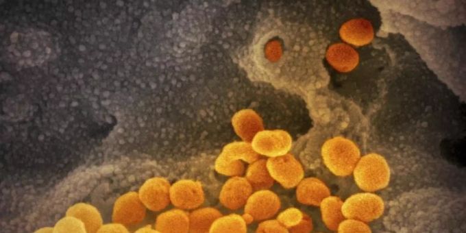 Eine elektronenmikroskopische Aufnahme zeigt das neuartige Coronavirus, das aus der Oberfläche von im Labor kultivierten Zellen austritt. Foto: NIAID-RML/AP/dpa Eine elektronenmikroskopische Aufnahme zeigt das neuartige Coronavirus, das aus der Oberfläche von im Labor kultivierten Zellen austritt. Foto: NIAID-RML/AP/dpa