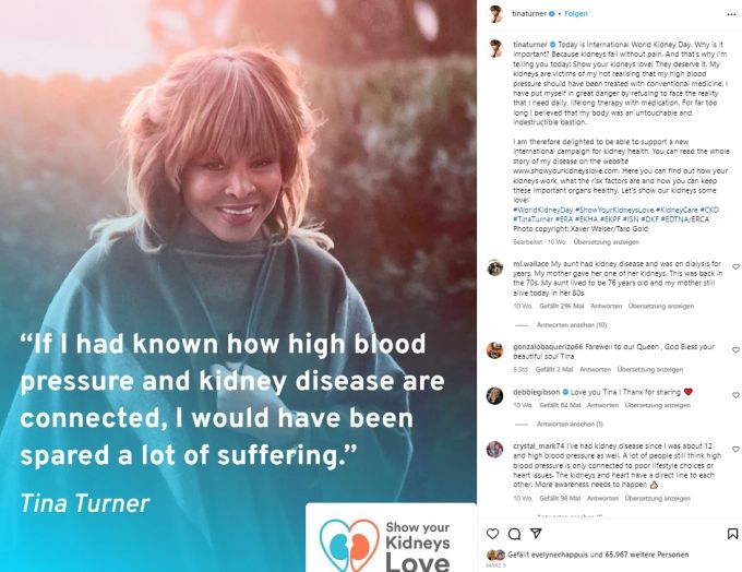 Nur kurz vor ihrem Tod sprach Tina Turner über ihre Nieren-Probleme. Tina Turner