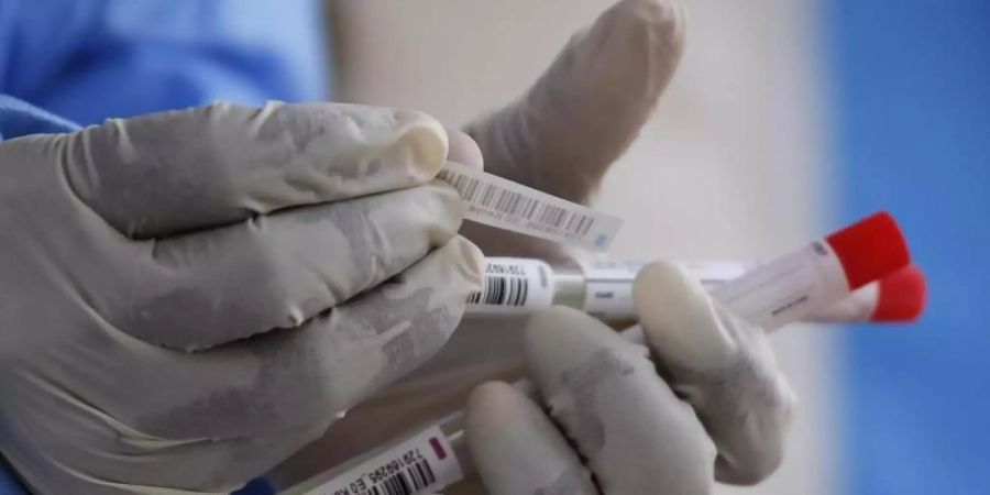 Eine Labortechnikerin bereitet Nasenabstriche für einen Test zur Ermittlung des Coronavirus in einem pathologischem Labor vor. Foto: Brian Inganga/AP/dpa