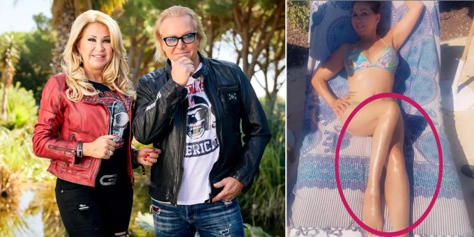 «Beine wie Krankheit» - Carmen Geiss wegen Fake-Bikinibild verspottet