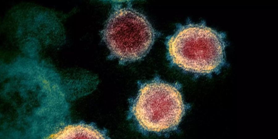 Eine elektronenmikroskopische Aufnahme des Coronavirus (SARS-CoV-2), das Covid-19 verursacht. Foto: -/NIAID-RML/AP/dpa