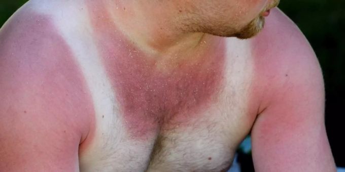 Hitze kann eine Gefahr für die Bevölkerung sein. Hitze