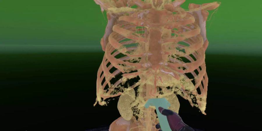 Blick durch eine Virtual-Reality (VR)-Brille auf Brustkorb (rot) und Organe (gelb) in 3D. Mit dem Controller (blau) lässt sich der Torso im Raum drehen. Bild: Philippe Cattin