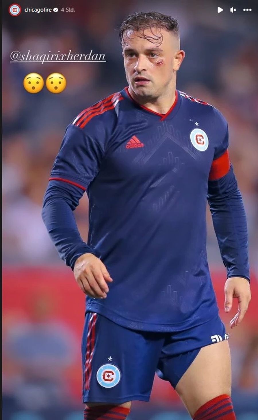 Xherdan Shaqiri