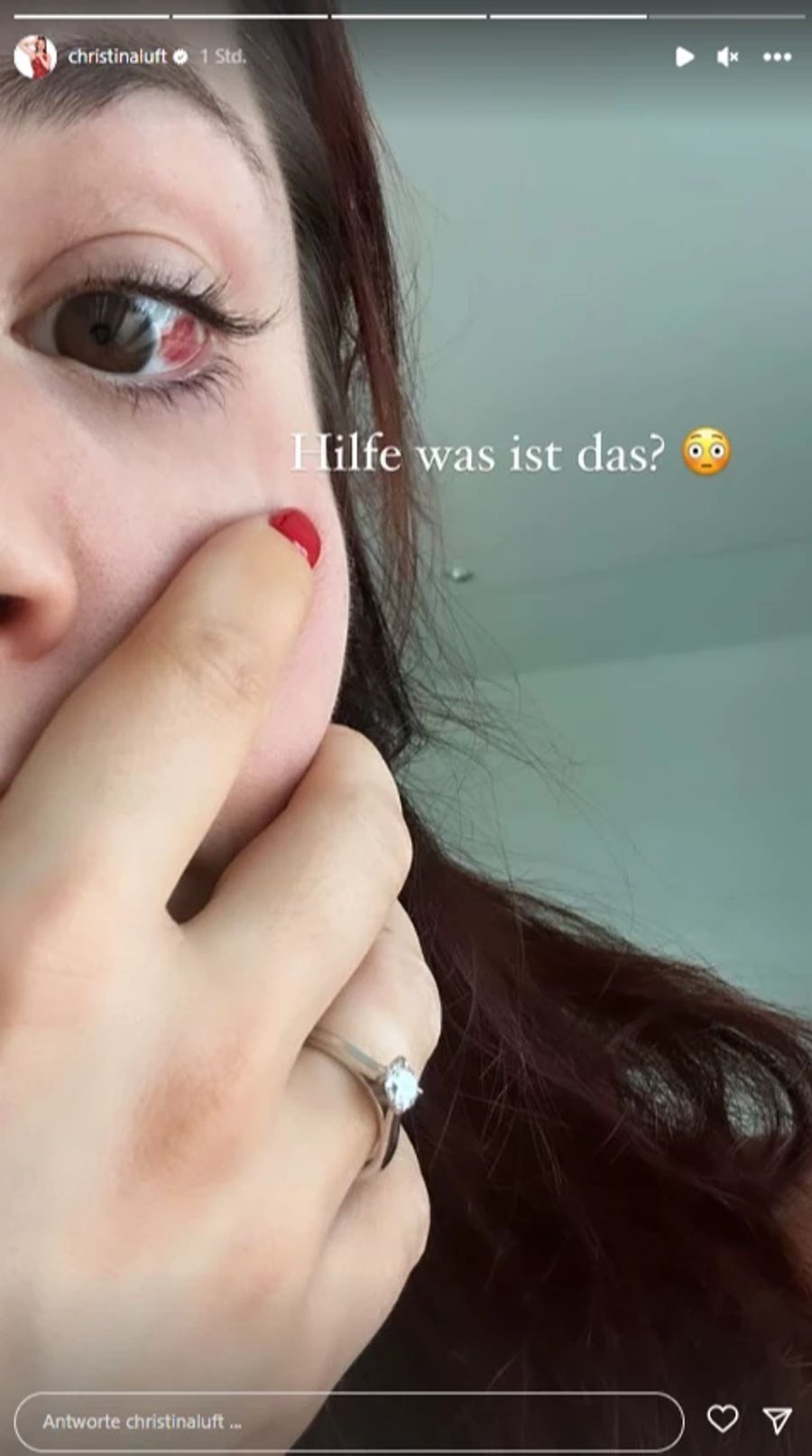 Christina Luft hat einen Fleck im Auge – und bittet ihre Fans um Ratschlag.