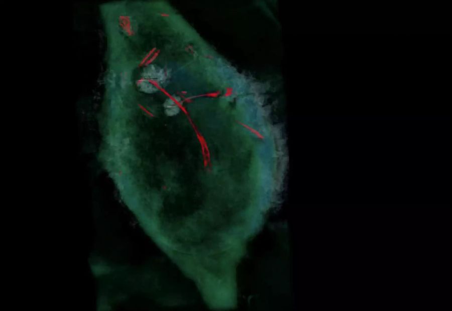 Nanoröhrchen Speere Membran