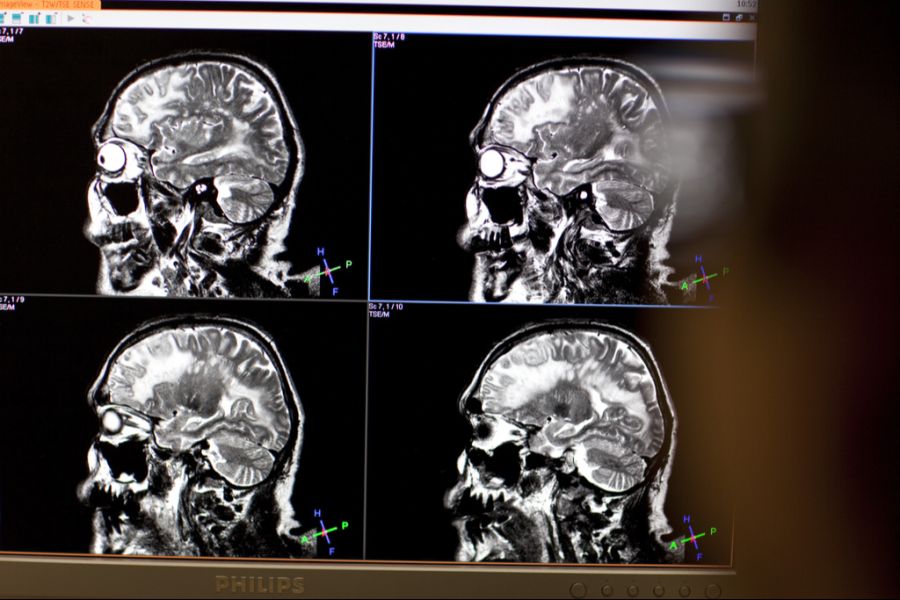 Das durchgeführte MRI gibt Entwarnung: Es ist alles gut. (Symbolbild)