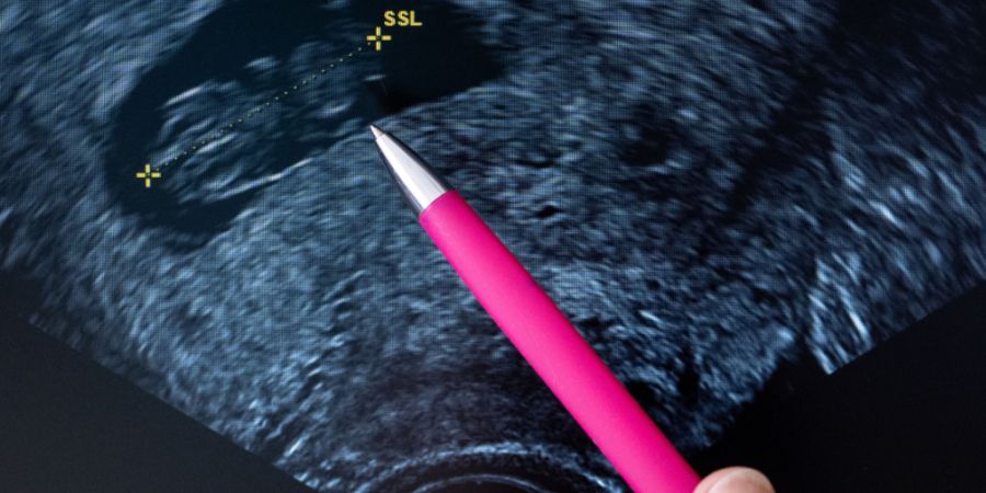 Das Berner Kantonsparlament sieht keinen Bedarf für zusätzliche Prävention von Schwangerschaftsabbrüchen. (Symbolbild)