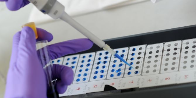 Antigen Antikörper