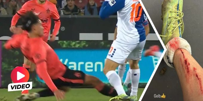 «Gelb!» - GC-Morandi zeigt Mordswunde nach Cup-Aus im Derby