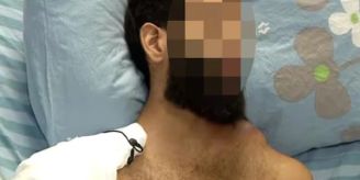 Überlebt - Krebskranker (20) warf sich an Festival auf Hamas-Granate