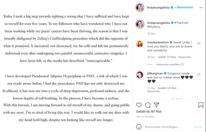 Mit dieser Botschaft auf Instagram berichtet Linda Evangelista von ihrer misslungenen Schönheits-OP. Linda Evangelista