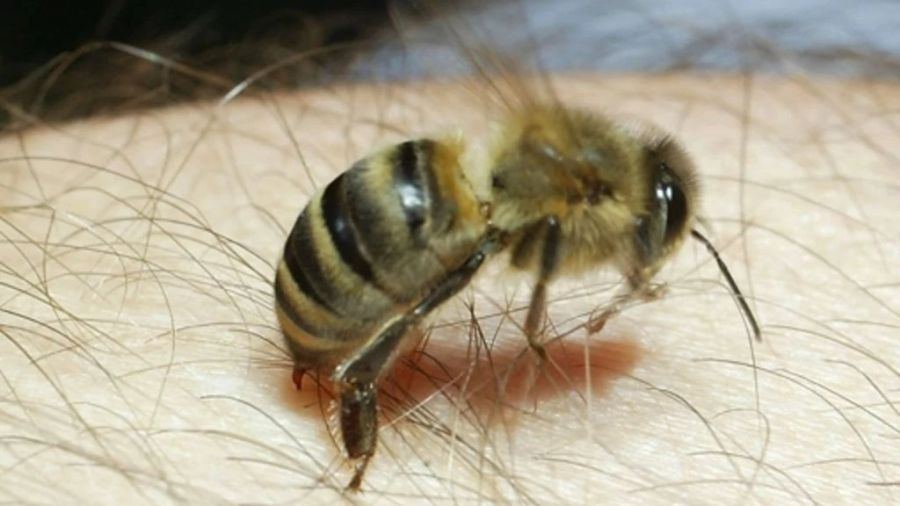 Das kann brennen. Es entsteht eine «Quaddel», ähnlich wie bei einem Bienenstich.