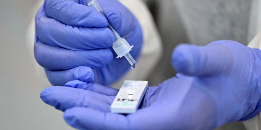 Forscher der Ludwig-Maximilians-Universität kommen zu dem Ergebnis: Handelsübliche Antigen-Schnelltests erkennen eine Omikron-Infektion schlechter als eine Delta-Infektion. Foto: Martin Schutt/dpa-Zentralbild/dpa
