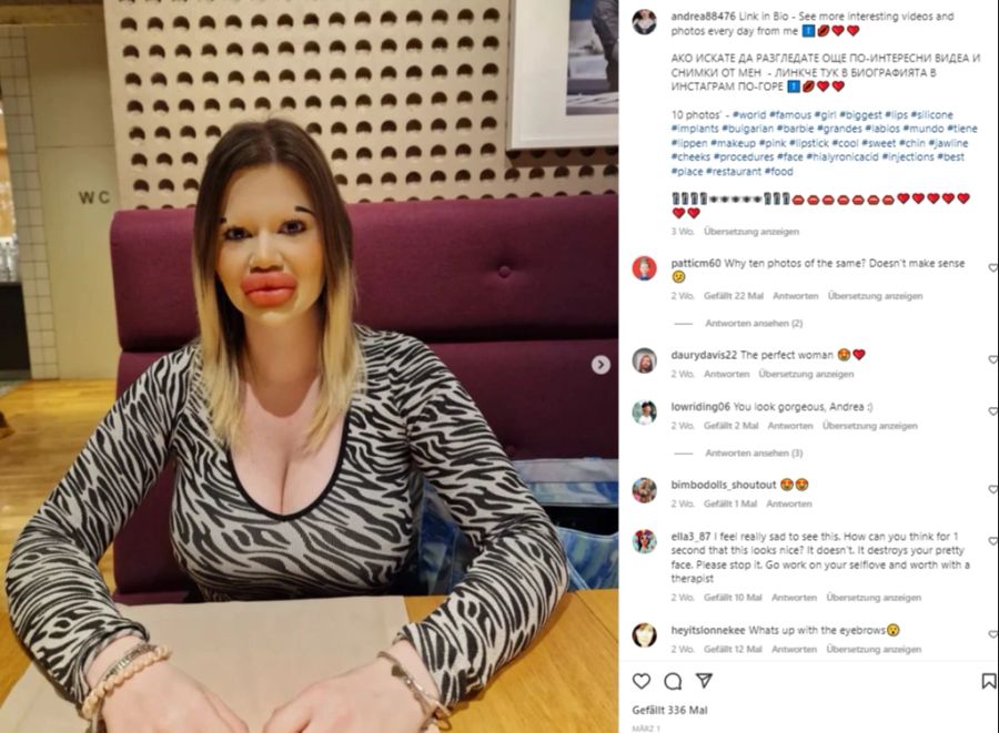 Andrea Ivanova schockt mit ihren XXXL-Lippen.