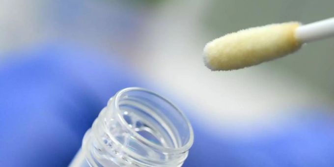 Kontrollen von Teststellen seitens der Gesundheitsämter sind schon deshalb schwierig, weil die Namen und Adressen der Testwilligen für die Abrechnung aus Datenschutzgründen nicht weitergegeben werden dürfen. Foto: Sebastian Gollnow/dpa Kontrollen von Teststellen seitens der Gesundheitsämter sind schon deshalb schwierig, weil die Namen und Adressen der Testwilligen für die Abrechnung aus Datenschutzgründen nicht weitergegeben werden dürfen. Foto: Sebastian Gollnow/dpa