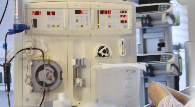 Wegen des Gendefekts wird bei der Dialyse überschüssiges Wasser nicht vollständig entfernt. dialyse