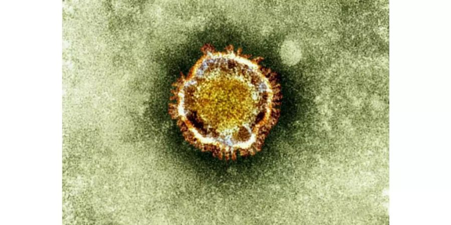 coronavirus