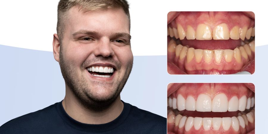 bestsmile