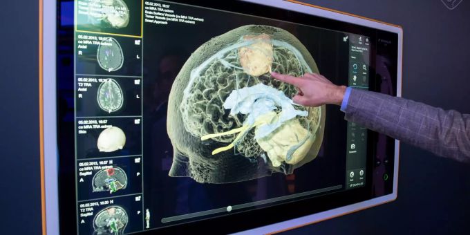 Ein Mitarbeiter des deutschen Unternehmens Brainlab AG demonstriert auf einem Digital-Gipfel eine durch KI-getriebene anatomische Segmentierung eines menschlichen Schädels. Eine durch KI-getriebene anatomische Segmentierung eines menschlichen