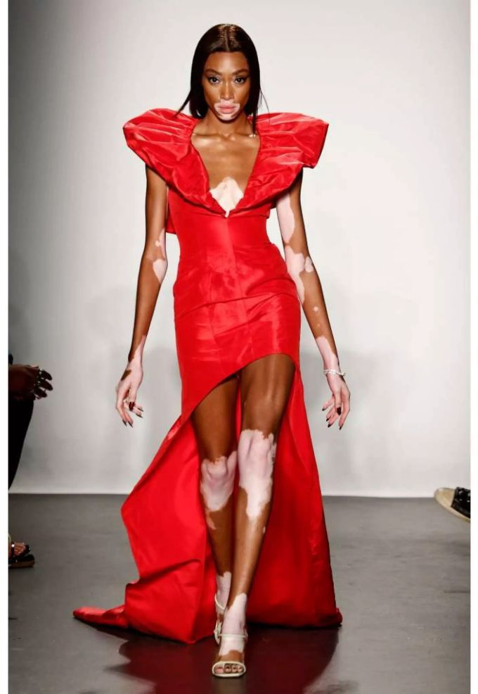 Model Winnie Harlow, hier auf dem Laufsteg der Laquan Smith Fashion Show an der New York Fashion Week. Model Winnie Harlow, hier auf dem Laufsteg der Laquan Smith Fashion Show an der New York Fashion Week.