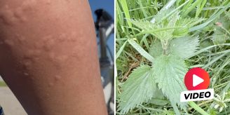 Belp BE - Expat warnt vor «gefährlicher Grasart» – es sind Brennnesseln