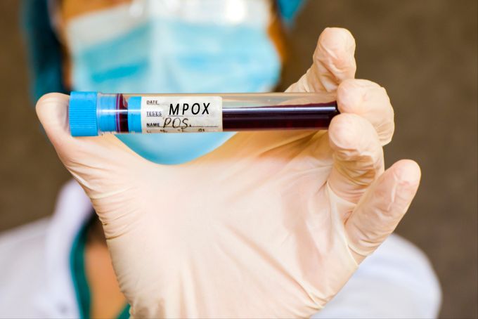 Mpox überträgt sich durch Hautkontakt. mpox