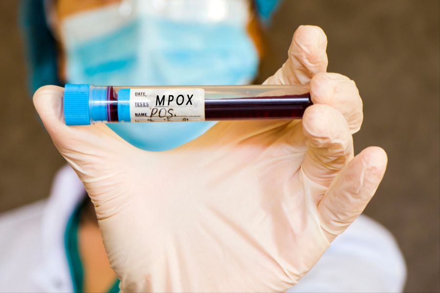 mpox