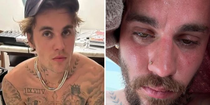 Justin Bieber