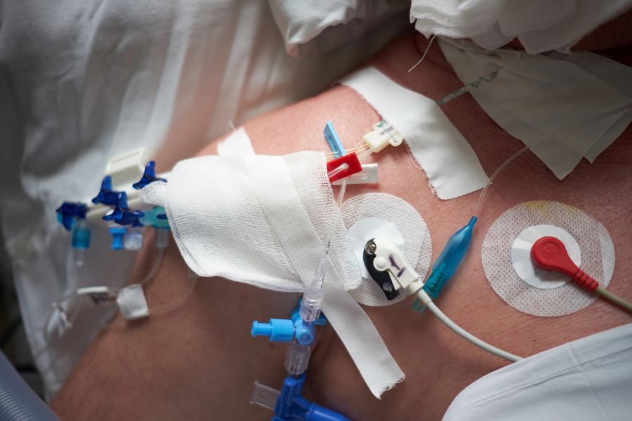 Statt einer offenen Herz-OP kann die Transplantation über einen Katheter erfolgen. (Symbolbild)