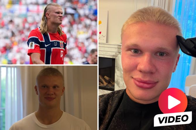 Erling Haaland Haare Rasur