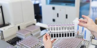 Keine Änderung - Bund wird Tarife für Laboranalysen selber festlegen