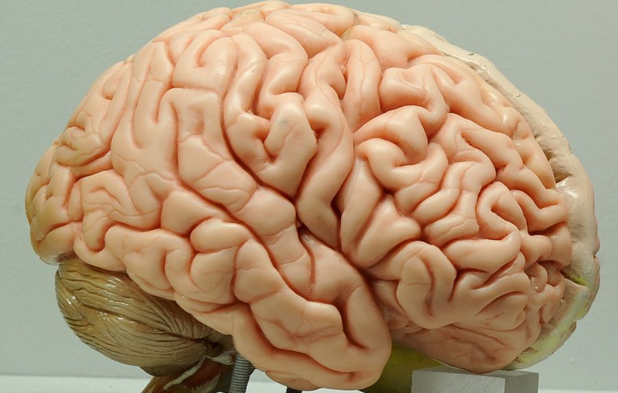 Jüngster Demenz-Patient Gehirn