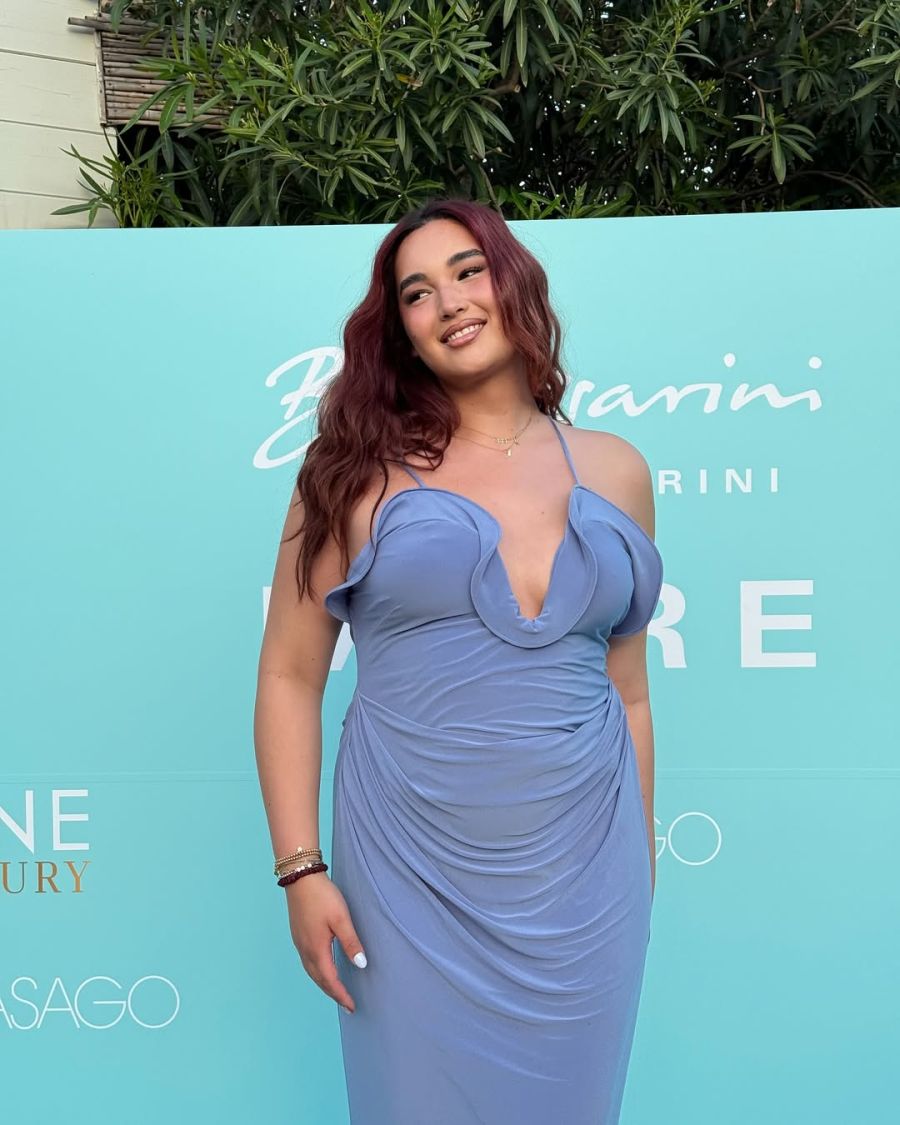 Vor knapp einem Jahr brachte das Model noch 26 Kilo mehr auf die Waage.
