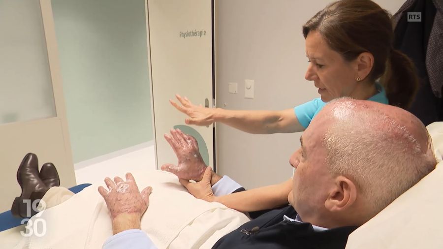 Philippe Germanier wurde am Kopf, am Rücken und vor allem an den Händen schwer verbrannt.