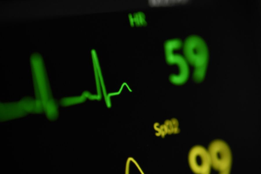 Am Unispital Lausanne unterstützt ein KI-Tool die Auswertung von EKGs bei Brustschmerzen. (Symbolbild)